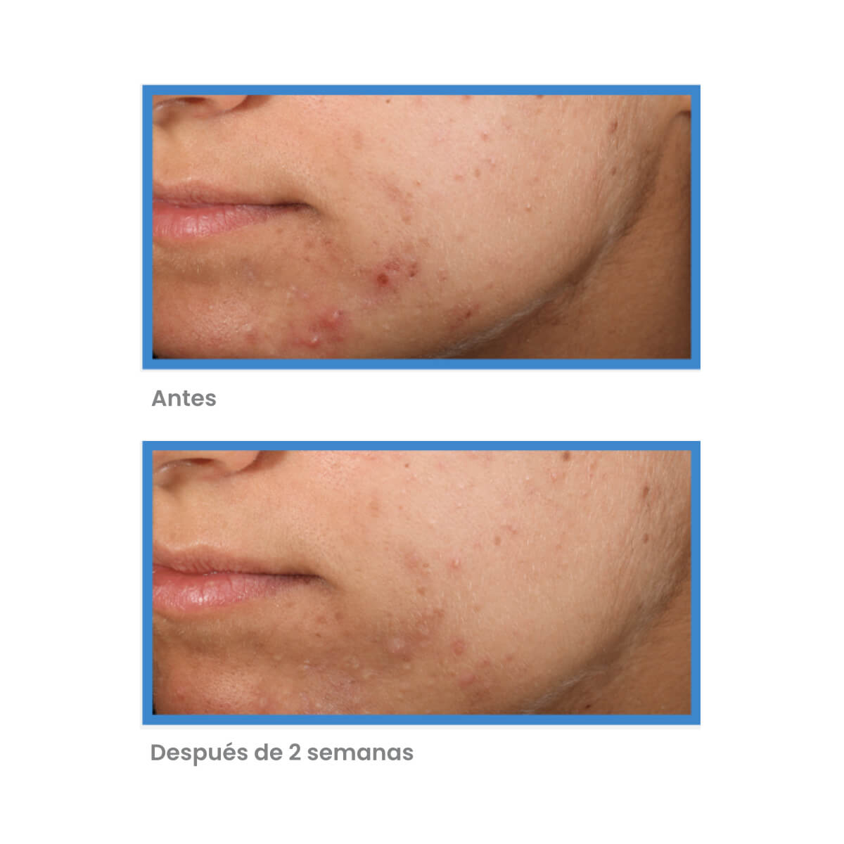 OUTSMART BLEMISH CLARIFYING TREATMENT 50 ML